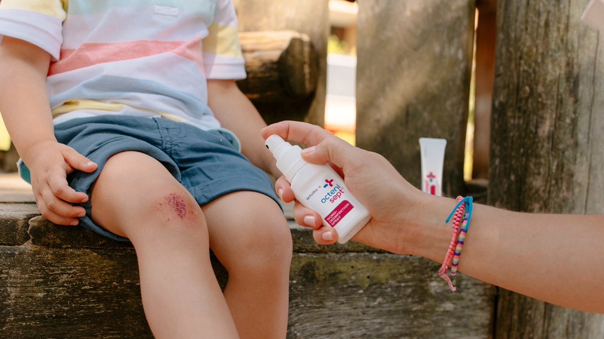 mutter beim Kinderwunden Richtig Versorgen mit octenisept spray