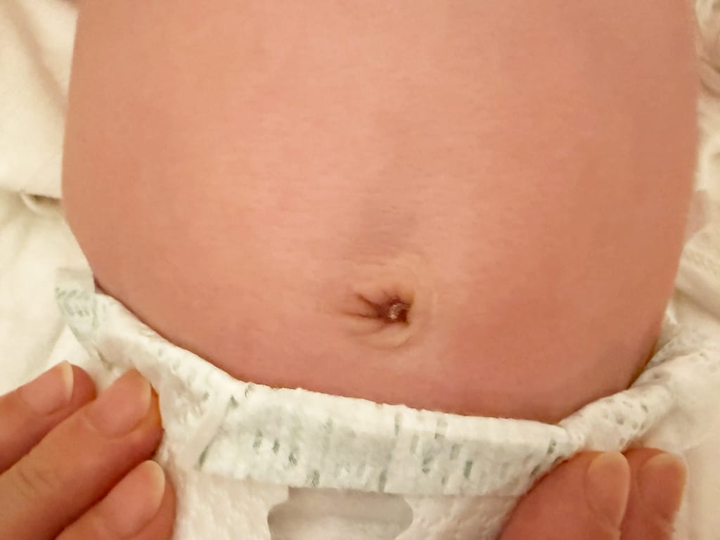 Bild eines verheilten nabels bei baby